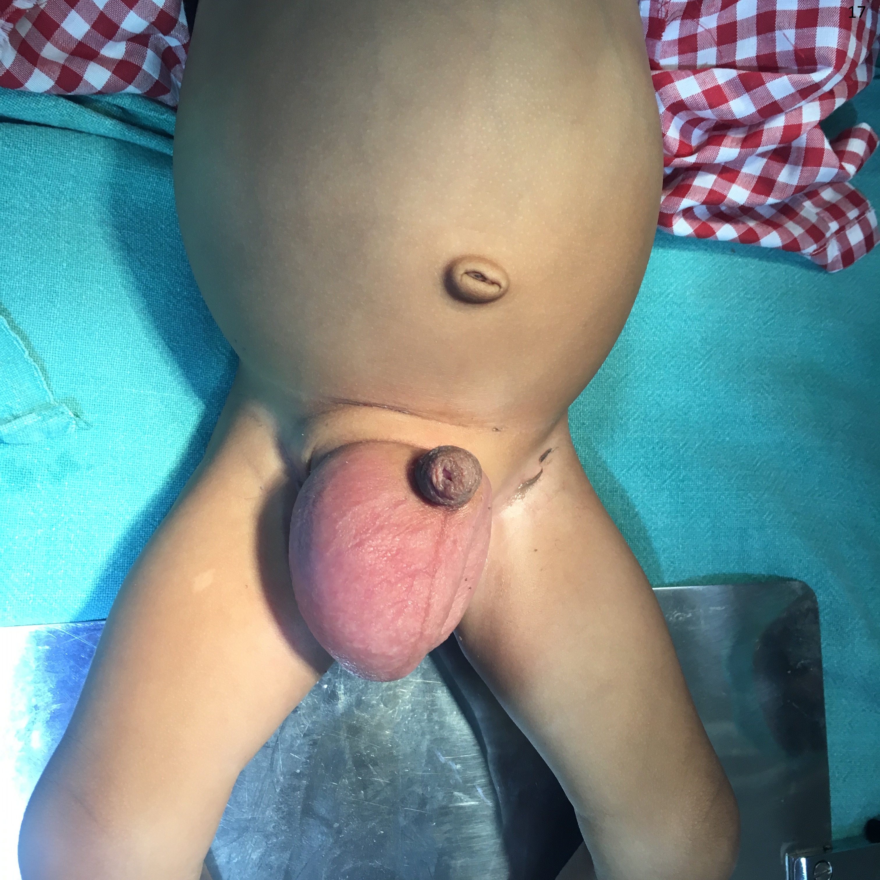 Pediatric General Surgery Image 5